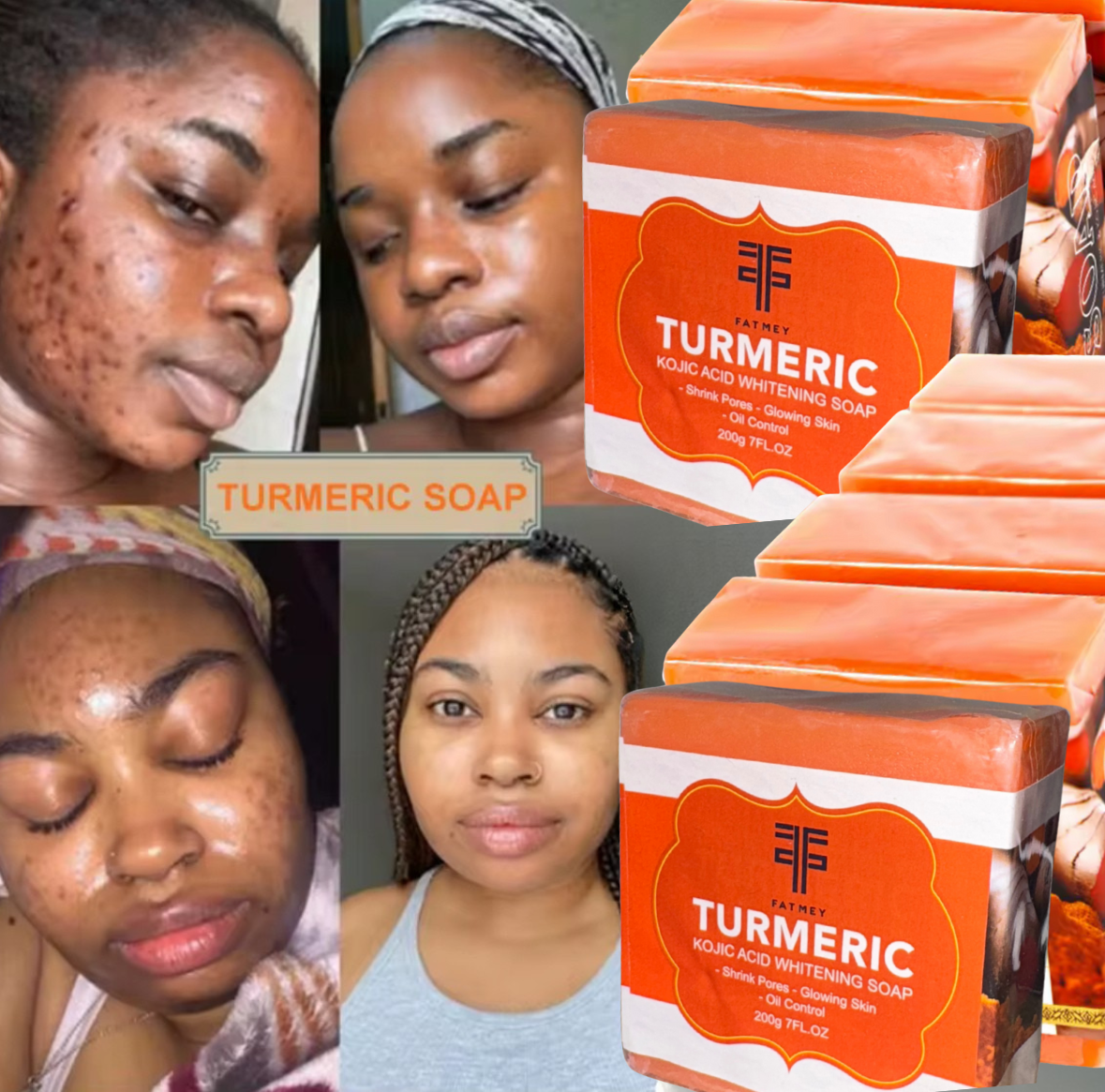 Turmeric soap