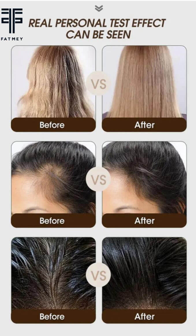 Anti-Hair Loss Range: Ginger and Tea Tree