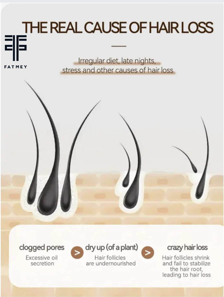 Anti-Hair Loss Range: Ginger and Tea Tree