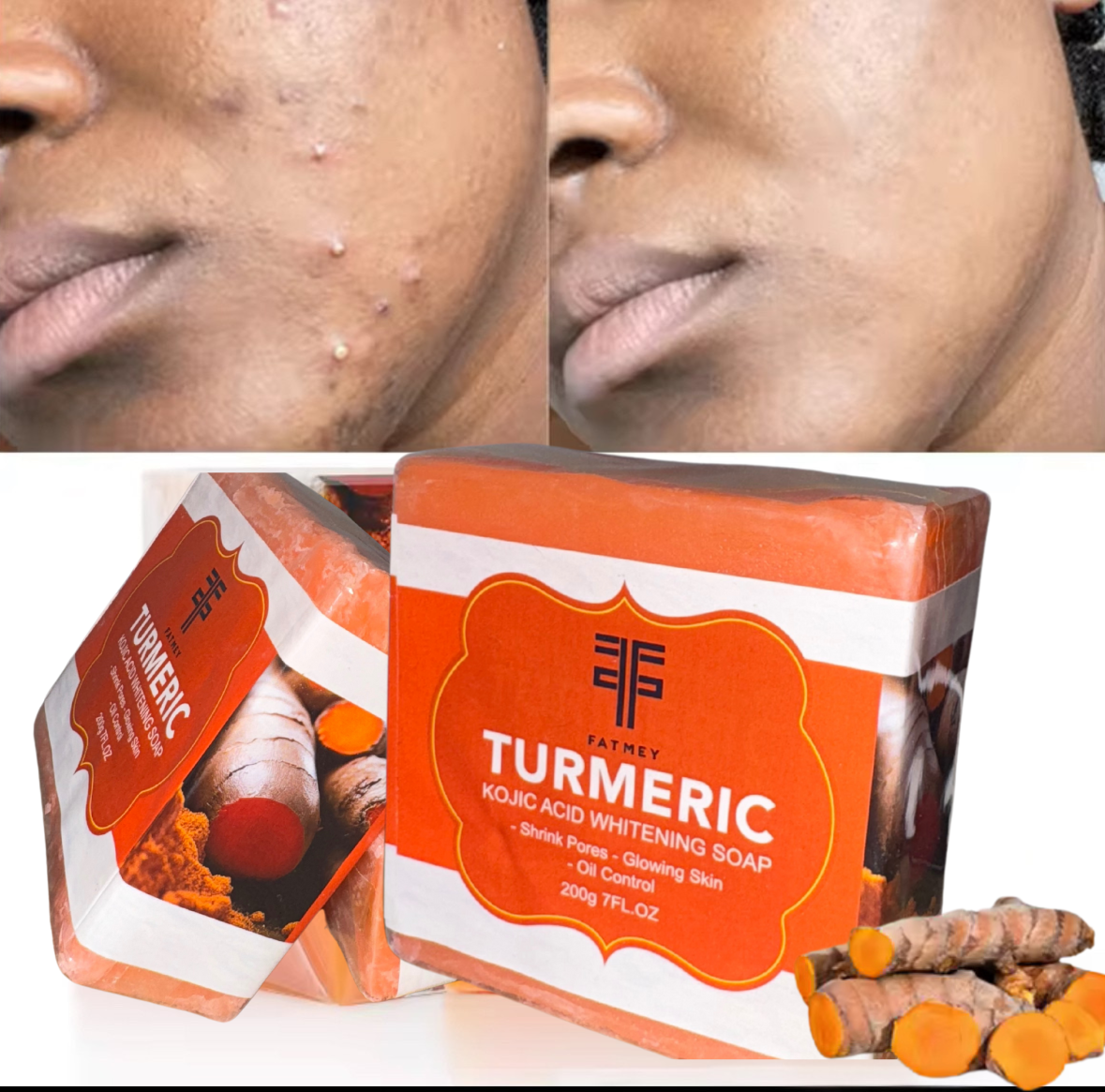 Turmeric soap