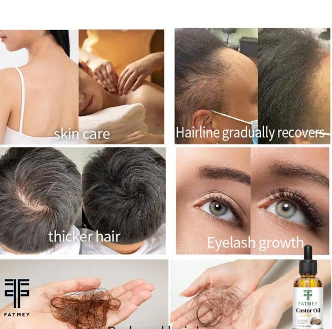 Jamaican Black Castor Oil